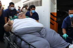 दुनिया के सबसे मोटे व्यक्ति की मेक्सिको में हुई सर्जरी