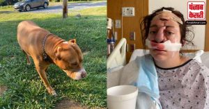 कुत्ते के हमले में युवती ने गवाई अपनी नाक,  सर्जरी से हुआ सुधार लेकिन बाद में खड़ी हो गयी ये बड़ी मुसीबत!