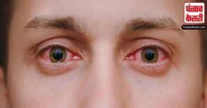 Eye Flu: किस वायरस की वजह से तेजी से फैल रहा आई फ्लू ?