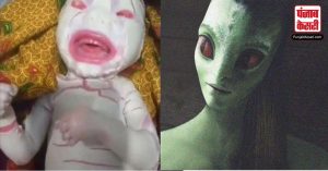 9 महीने बाद पैदा हुए बच्चे को देख उड़े सबके होश, आया एलियन जैसा नज़र, डॉक्टर्स हुए हैरान
