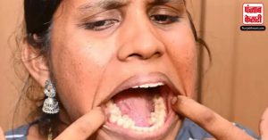इस महिला के मुंह में है इतने दांत की Guinness World Records में दर्ज हुआ नाम
