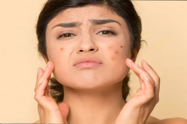 SKIN 1