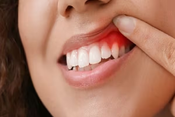 teeth