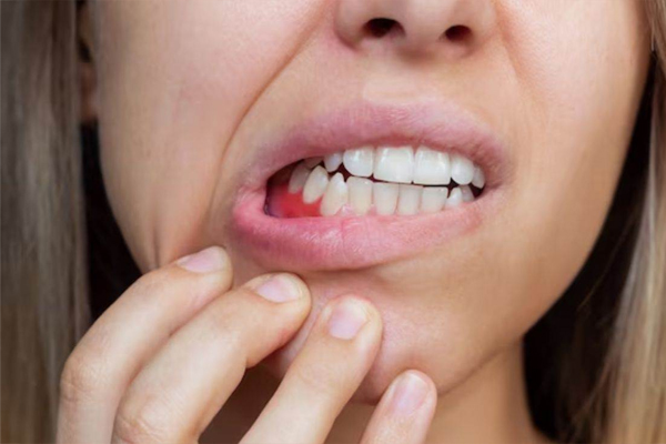 teeth4
