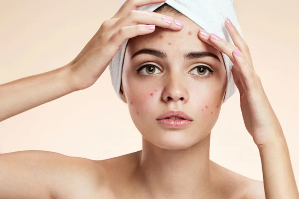 skin2