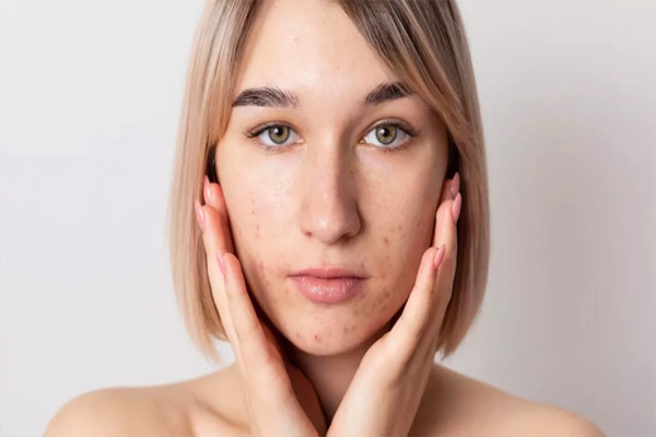 skin3