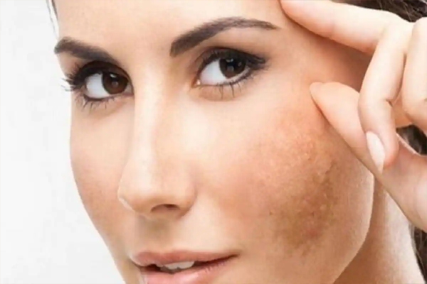 skin5