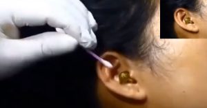 Viral Video: सोते समय महिला के कान में घुसा सांप, डॉक्टर के छूटे पसीने