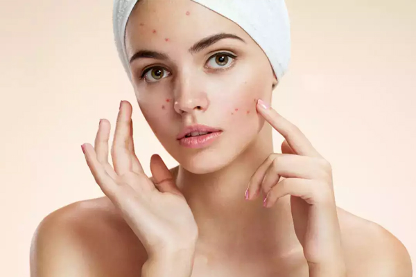 skin8