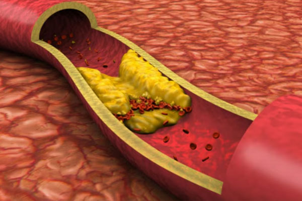 health3 20