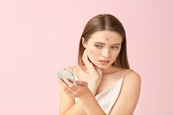 skin 4