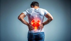 home remedies for kidney stones