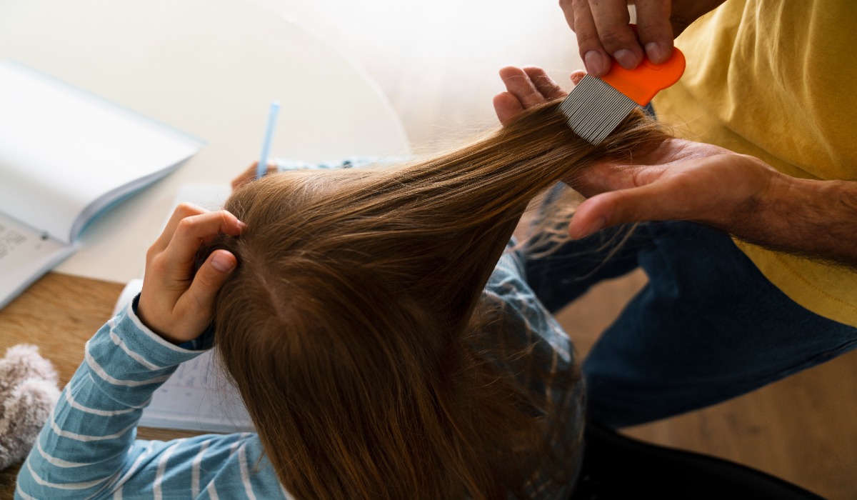 Lice Control Remedies