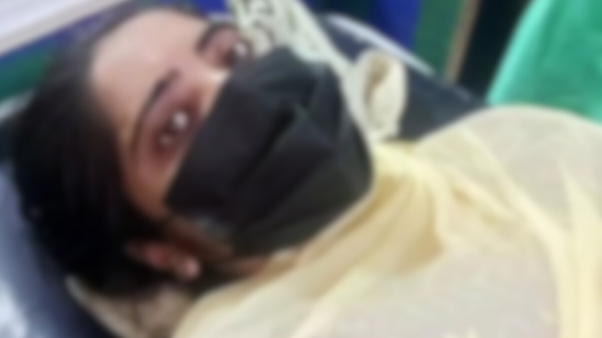 DU Acid Attack Case