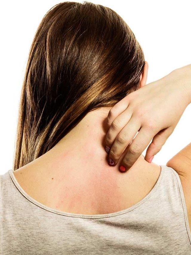 skin problems  स्किन पर बार बार खुजली होना किन बीमारियों का लक्षण है 