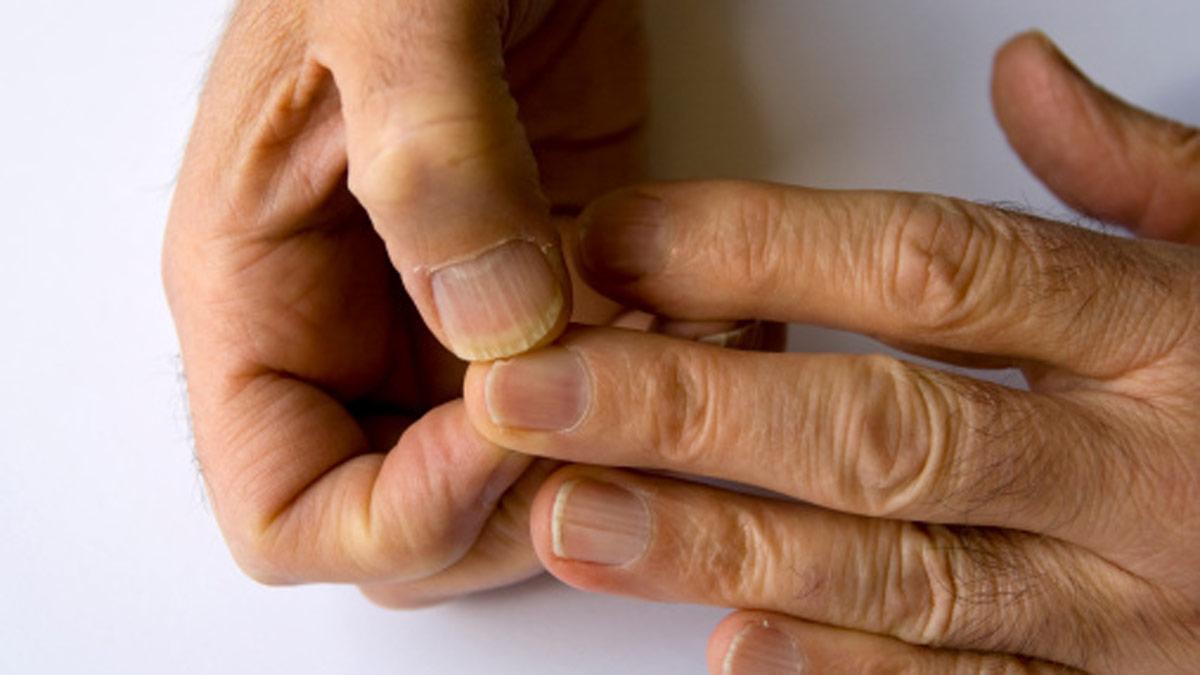 National Cancer Awareness Day 2025