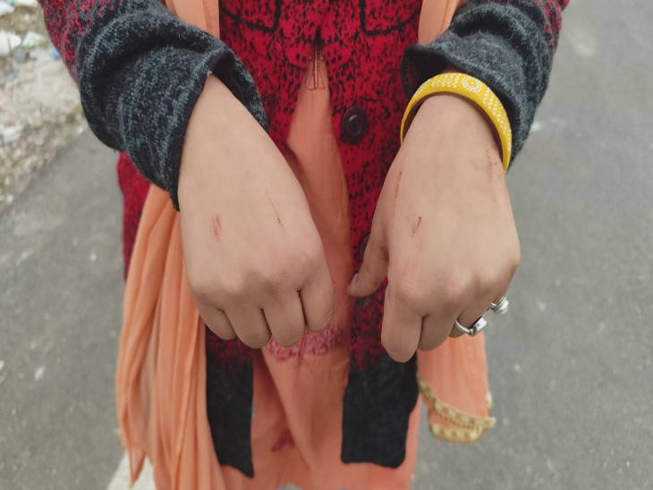 Kota PHD Scholar Robbery (CREDIT-SM)