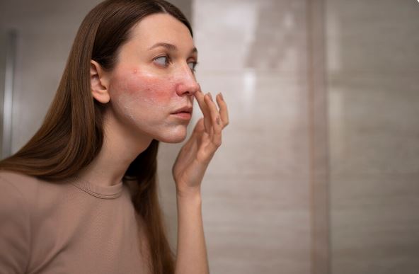 Sensitive Skin
